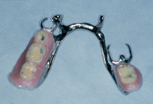 Cuidados de la prótesis dental removible