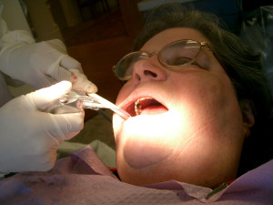 implantes dentales cirugía