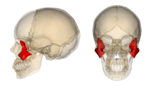 5 motivos para usar implantes zigomáticos