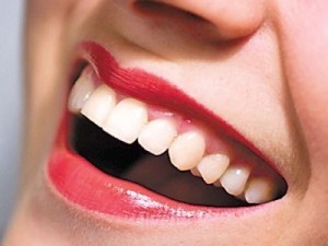 implantes dentales duración larga